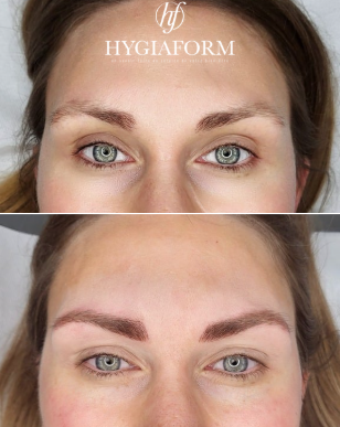 MICROPIGMENTATION DES SOURCILS