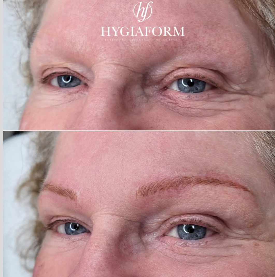 MICROPIGMENTATION DES SOURCILS